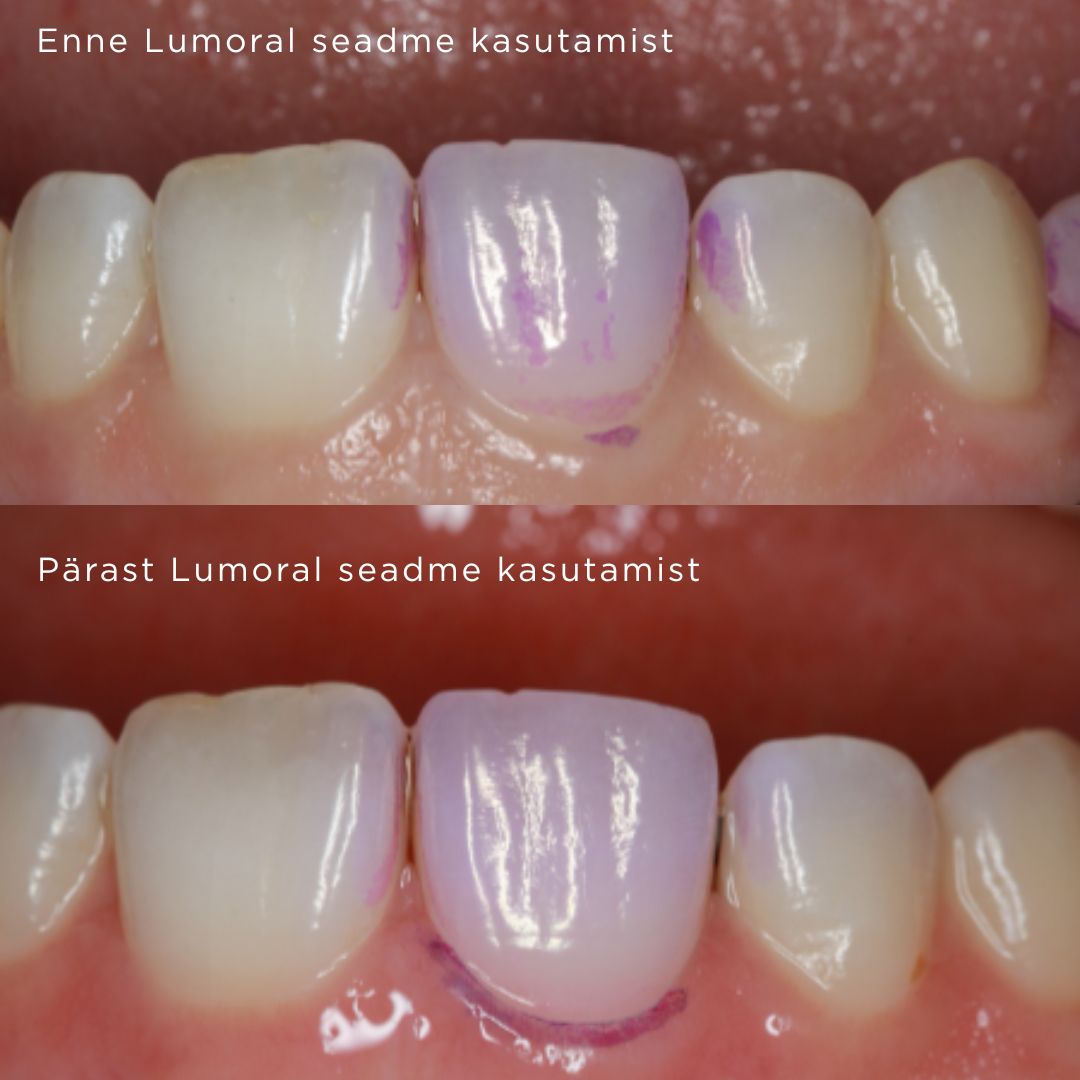 Red White Minimalist Shoes Sale Promotion Instagram Post 1 lumoral