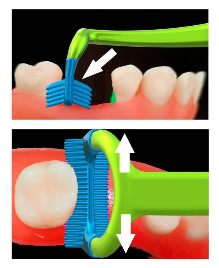ErgoProx proteeside eripuhastushari - Image 2